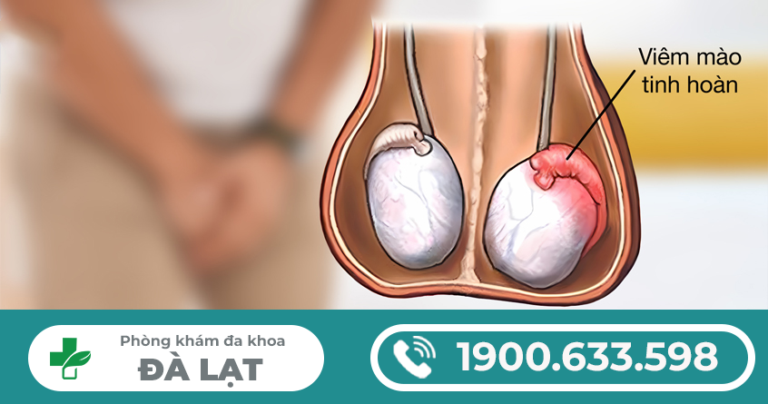 ĐAU TINH HOÀN CÓ NGUY HIỂM KHÔNG?  - PHƯƠNG PHAP ĐIỀU TRỊ HIỆU QUẢ NHẤT!